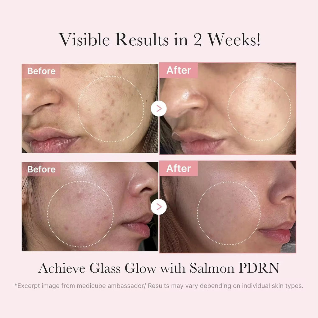 Medicube PDRN Glow Kit